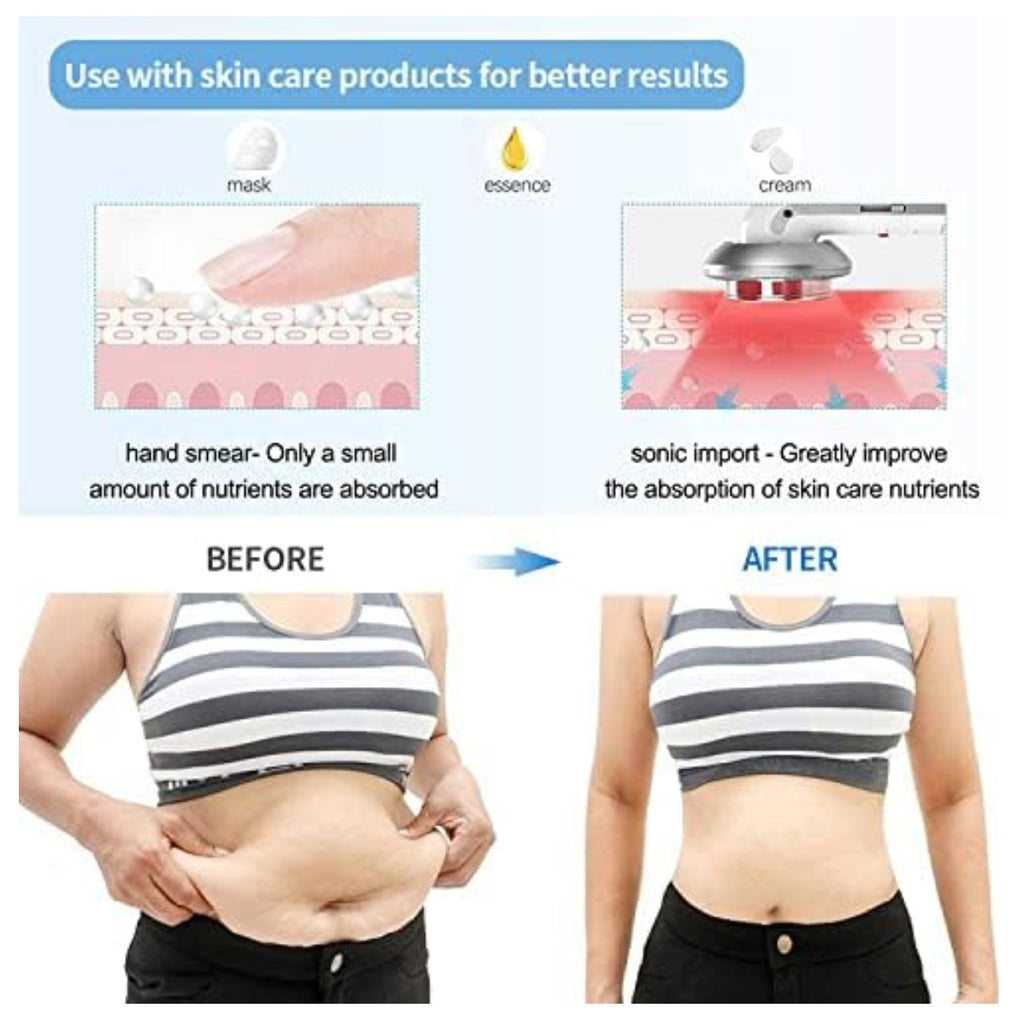Masajeador Anticelulitis Ultrasonido